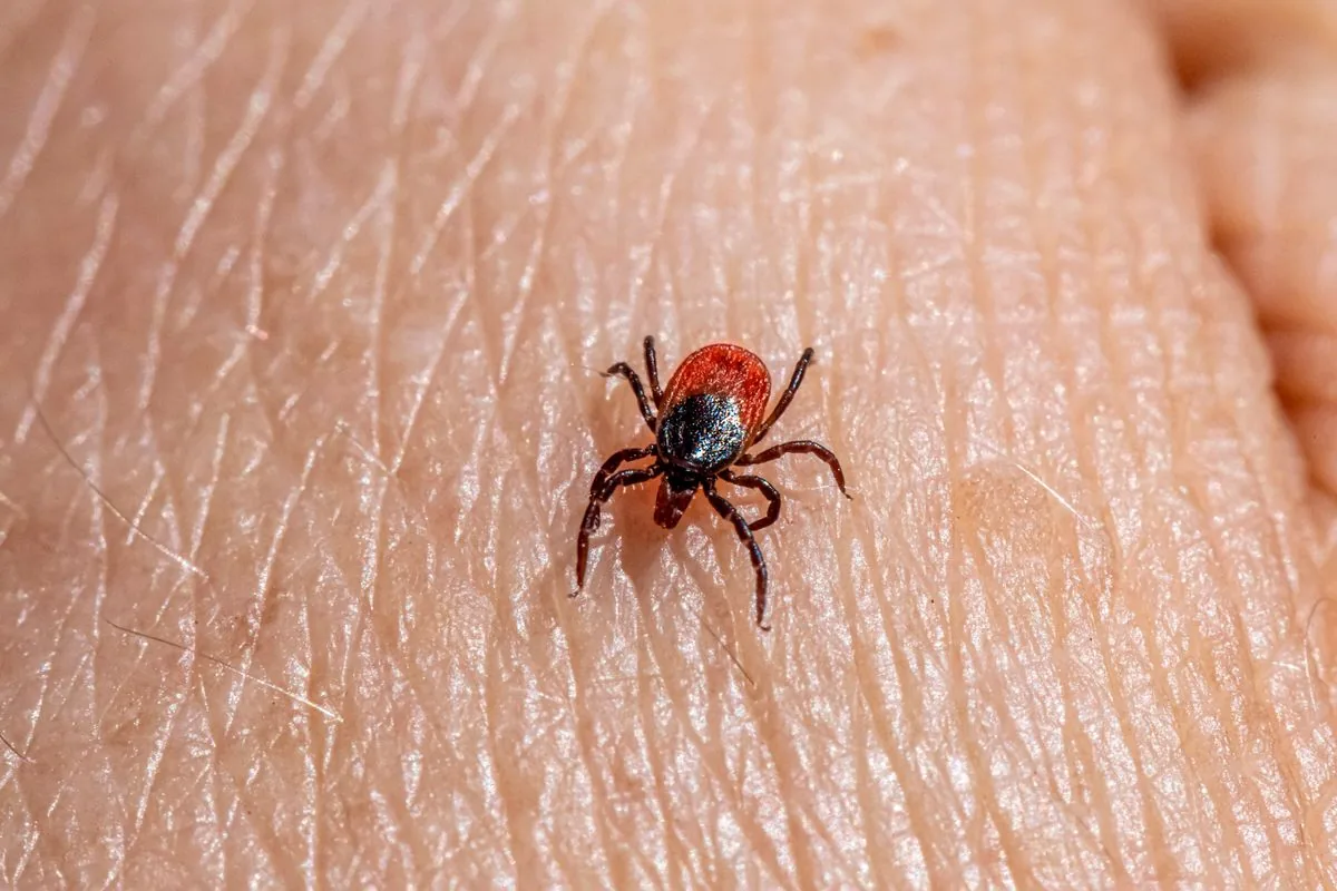 An Ixodes ricinus tick on human skin, the kind a walker might find during an evening tick check