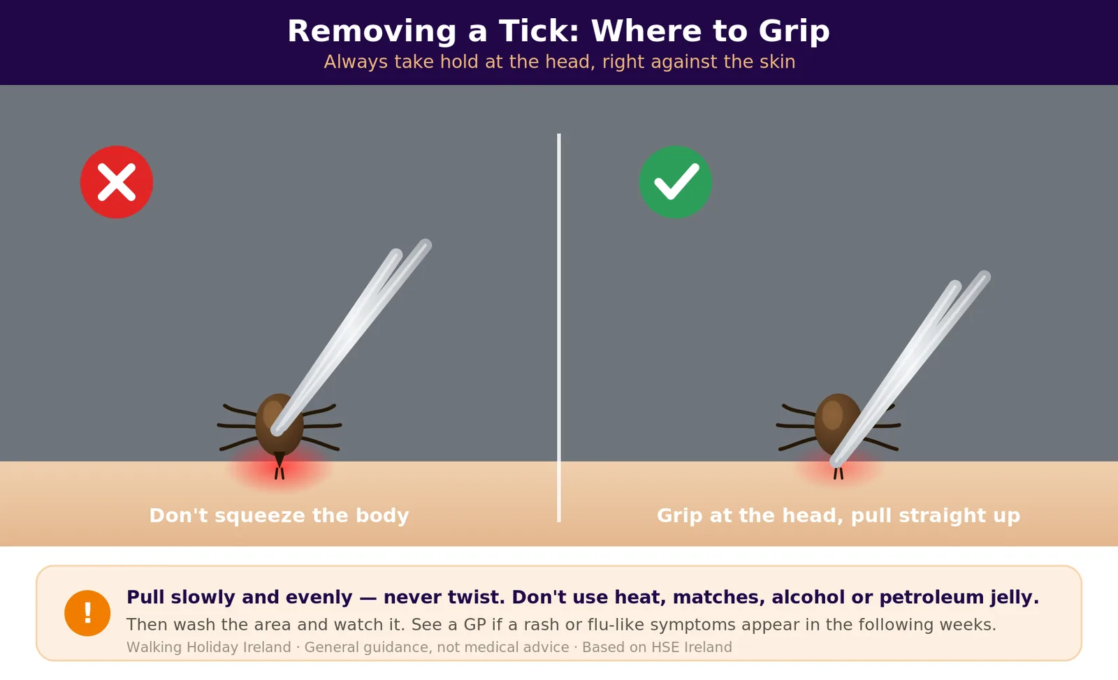 Diagram showing how to remove a tick safely: grip at the head close to the skin with fine-tipped tweezers and pull straight up, without twisting